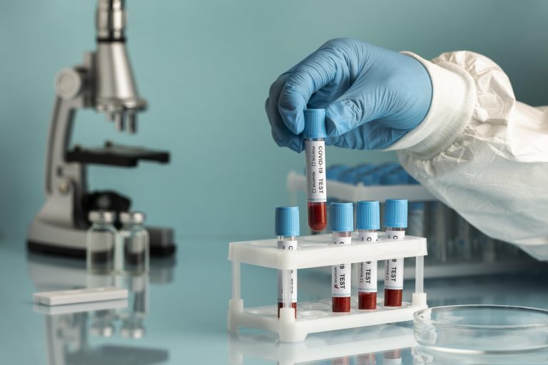 ตอบทุกข้อสงสัยเกี่ยวกับการตรวจภูมิโควิดด้วย Antibody test ต้องทำยังไง? ตรวจตอนไหนดีที่สุด? เช็กราคาค่าตรวจที่นี่ได้เลย